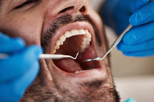 Best Root Canal Treatment  in Henrietta, TX