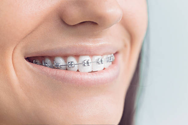 Best Invisalign and Clear Aligners  in Henrietta, TX